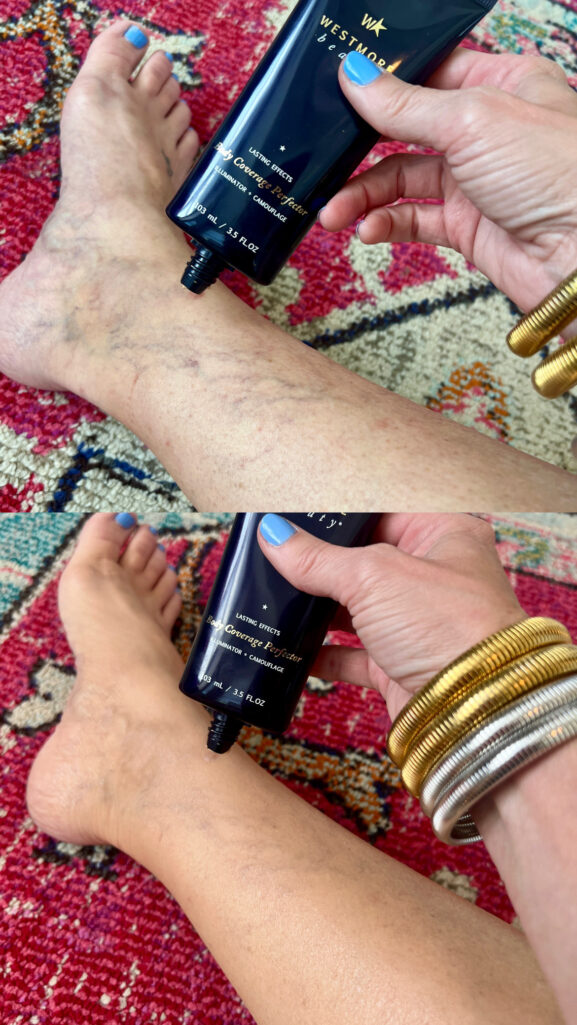 Before-and-after comparison of a woman's lower leg and ankle, showing visible varicose veins in the top image and smooth, even-toned skin in the bottom image after applying Westmore Beauty Body Coverage Perfector, with gold and silver stacked bracelets